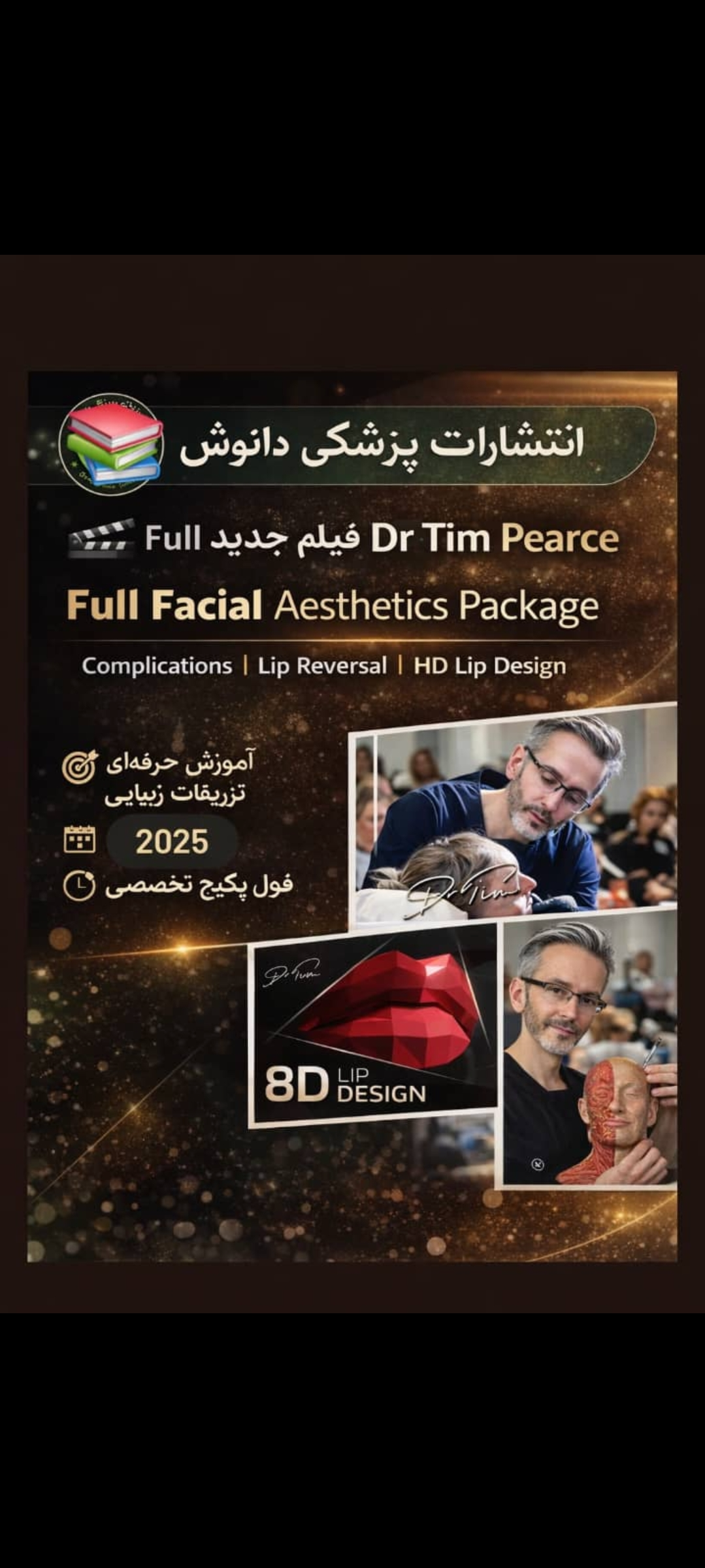 فیلم فول فیس فیلر و بوتاکس 2026 از دکتر تیم پیرز