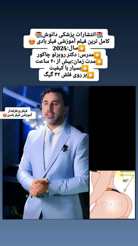 فیلم آموزشی تزریق فیلر باسن – دکتر چاکور ۲۰۲۴