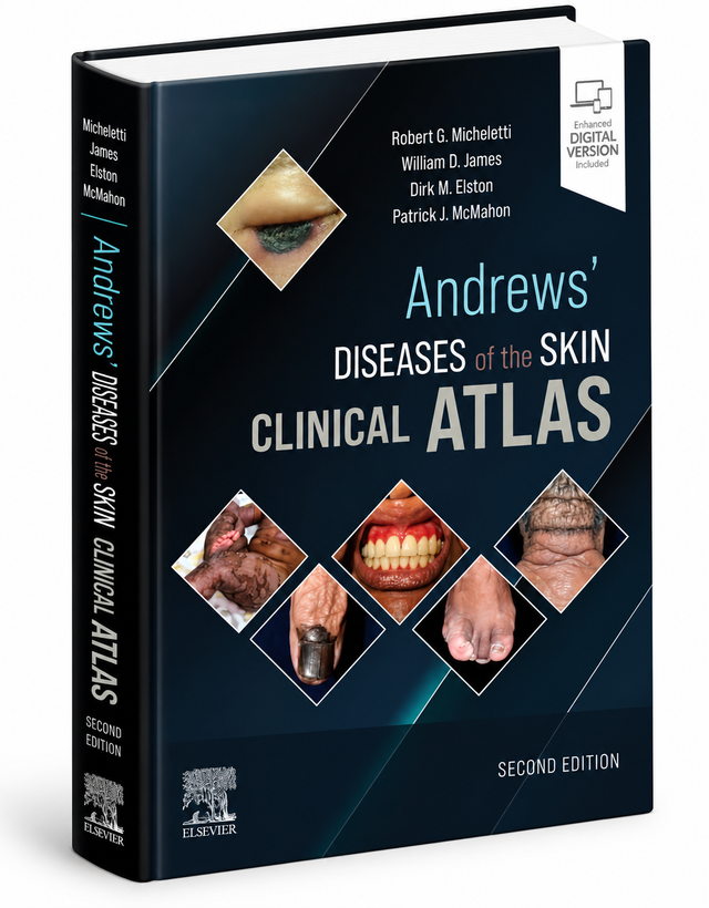 Andrews’ Diseases of the Skin: Clinical Atlas, 2nd Edition