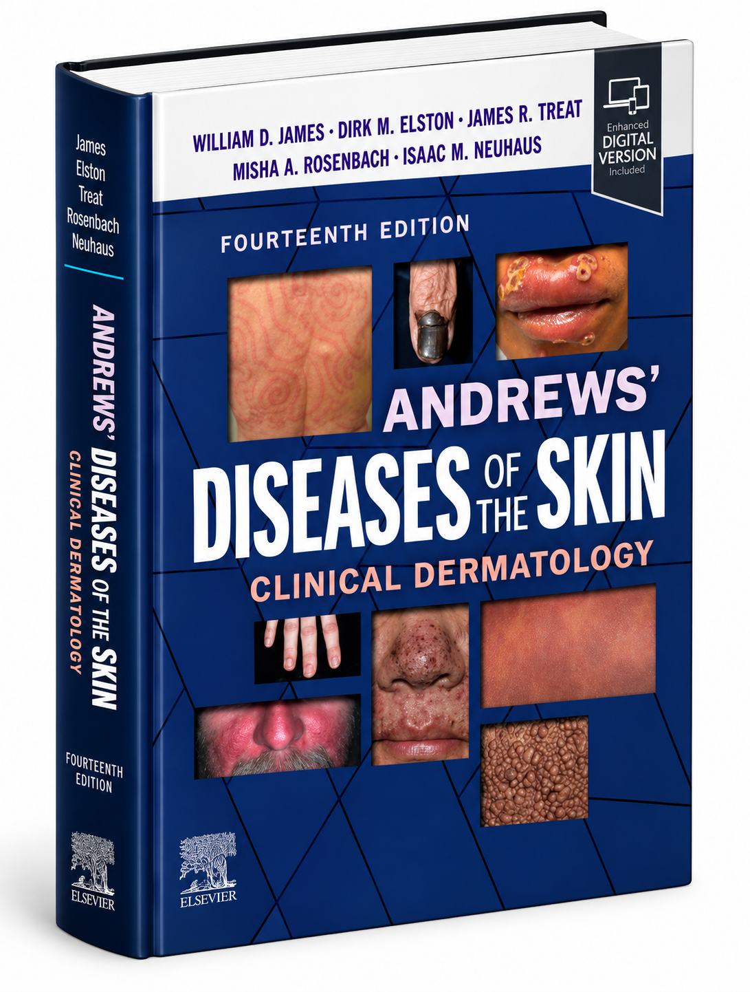 Andrews’ Diseases of the Skin: Clinical Dermatology, 14th Edition