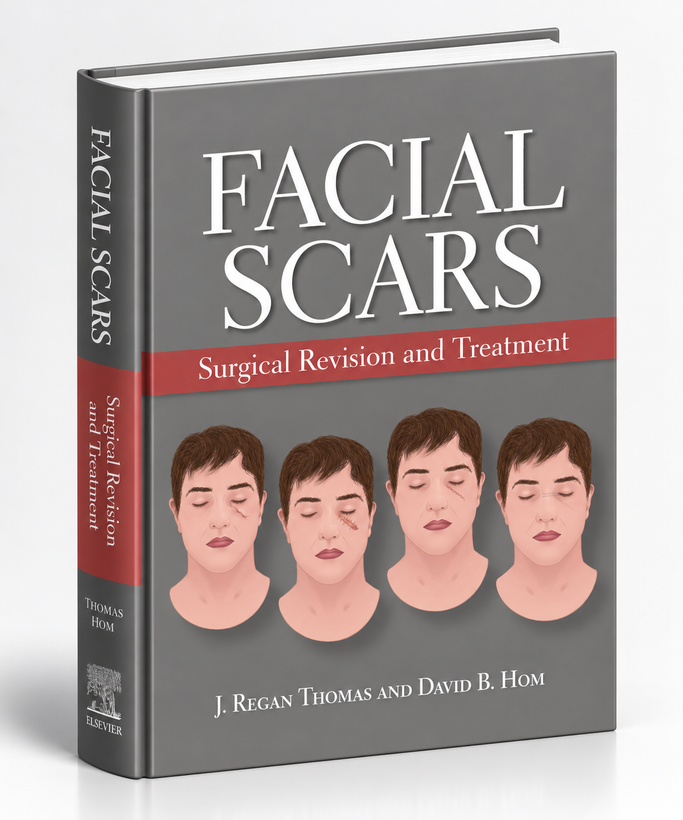 Facial Scars: Surgical Revision and Treatment