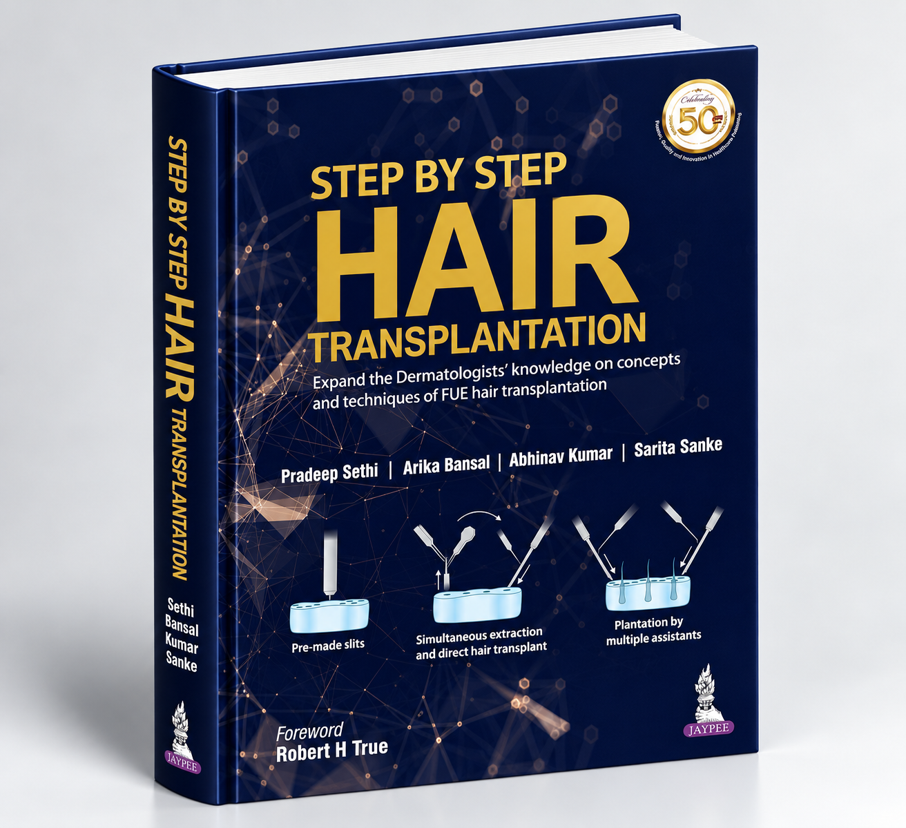Step by Step Hair Transplantation