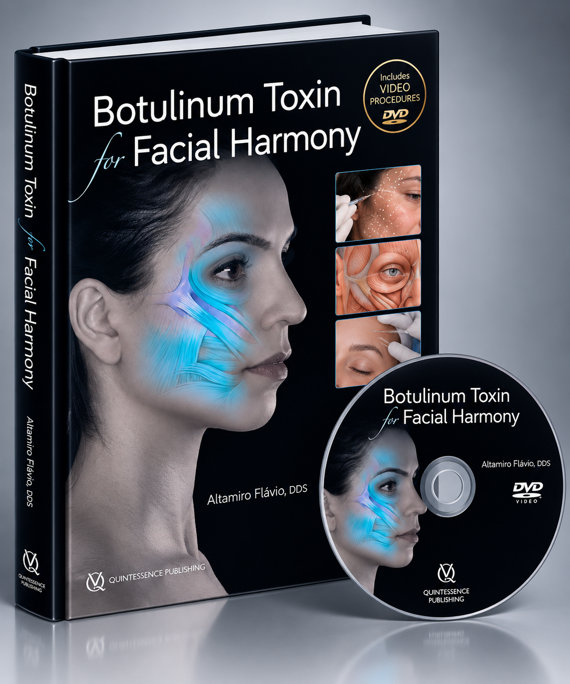 Botulinum Toxin for Facial Harmony