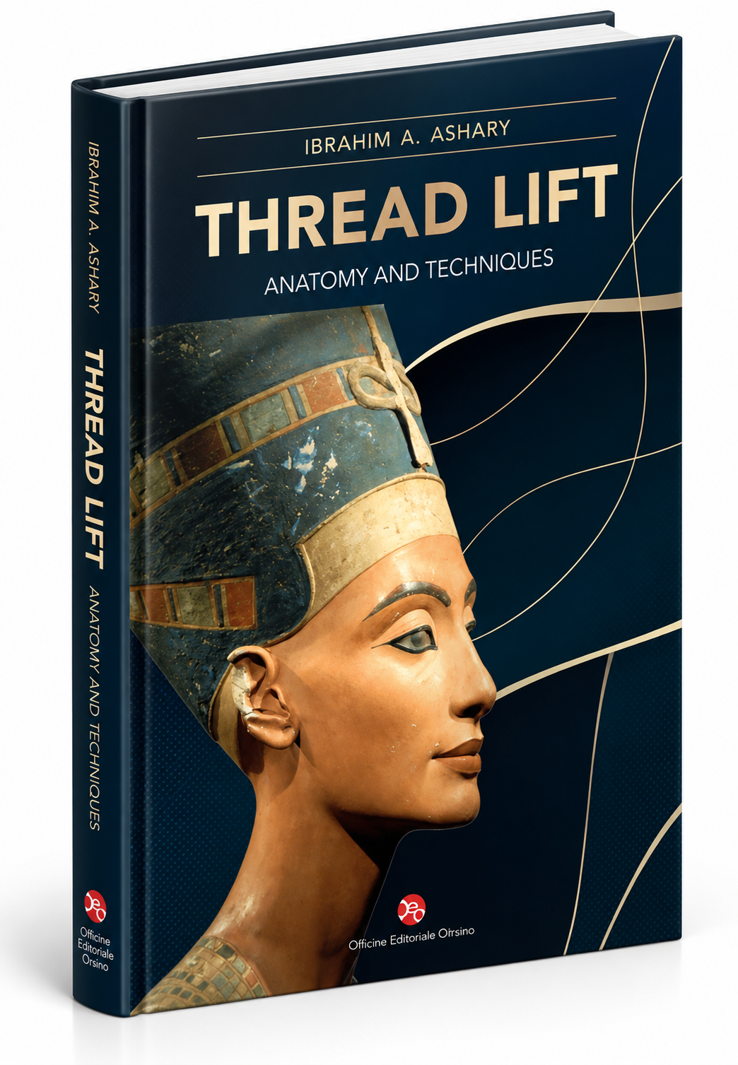 Thread Lift: Anatomy and Techniques