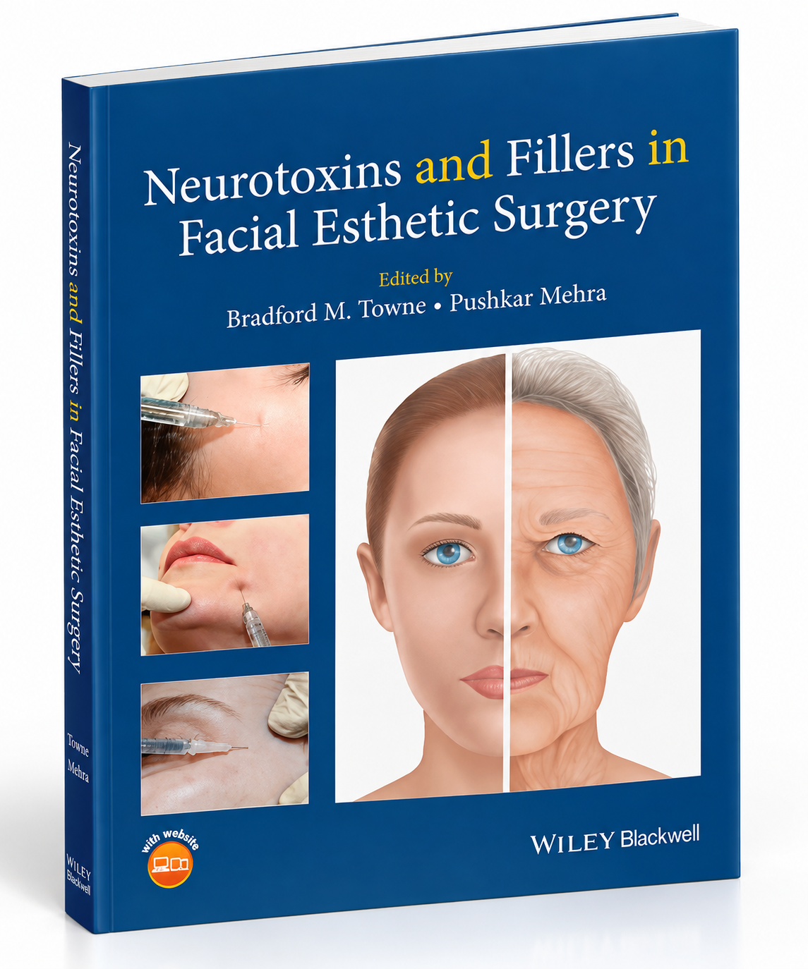 Neurotoxins and Fillers in Facial Esthetic Surgery