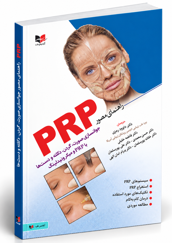 راهنمای مصور PRP