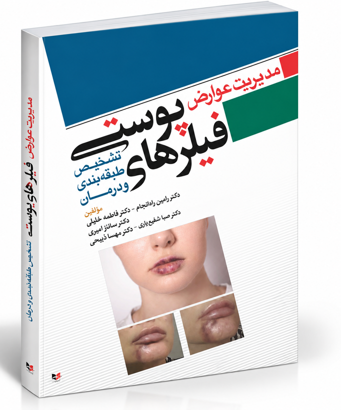 مدیریت عوارض فیلرهای پوستی؛ تشخیص، طبقهبندی و درمان