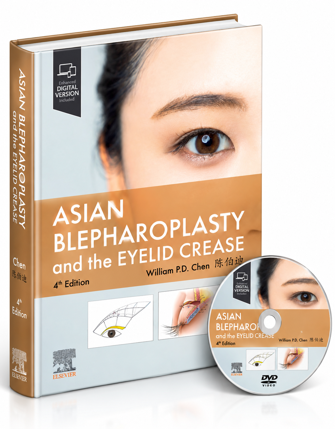 Asian Blepharoplasty and the Eyelid Crease – 4th Edition
