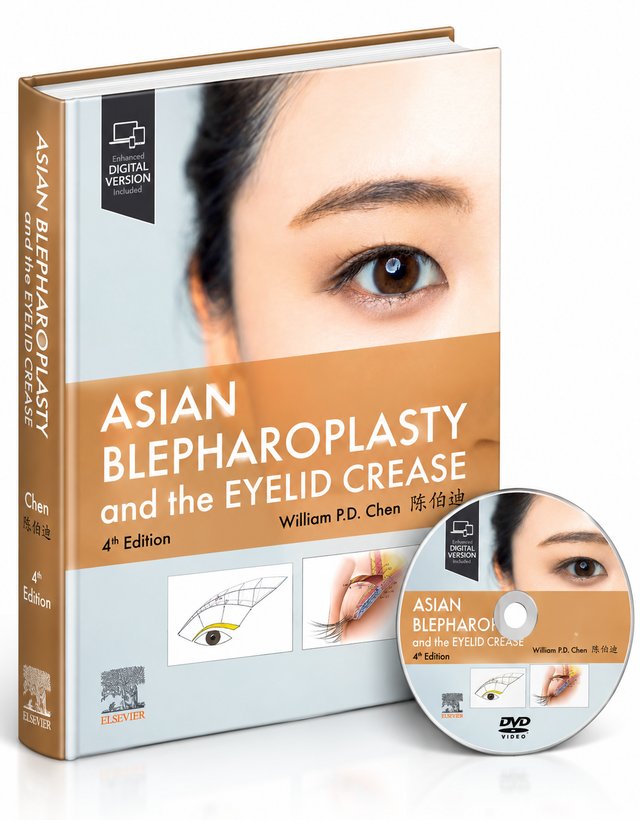 Asian Blepharoplasty and the Eyelid Crease – 4th Edition