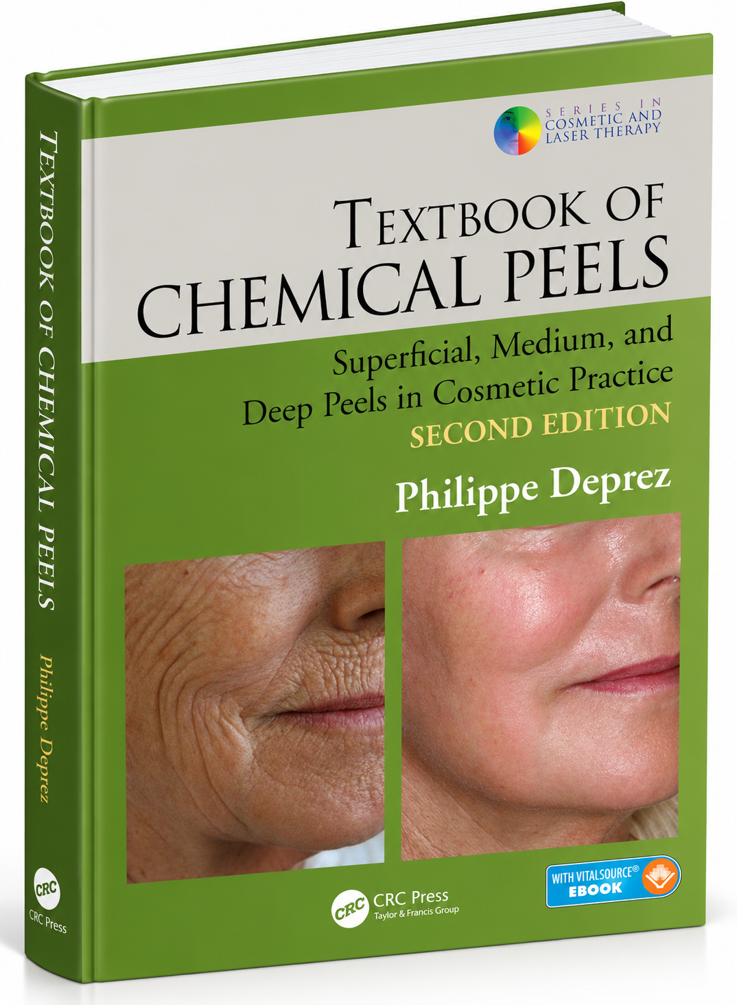 Textbook of Chemical Peels: Superficial, Medium, and Deep Peels in Cosmetic Practice – Second Edition