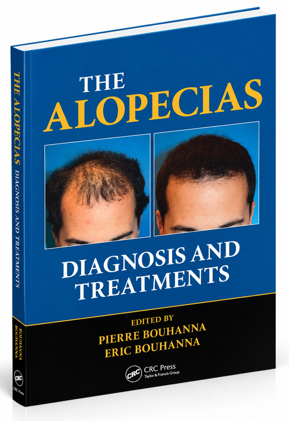 The Alopecias: Diagnosis and Treatments